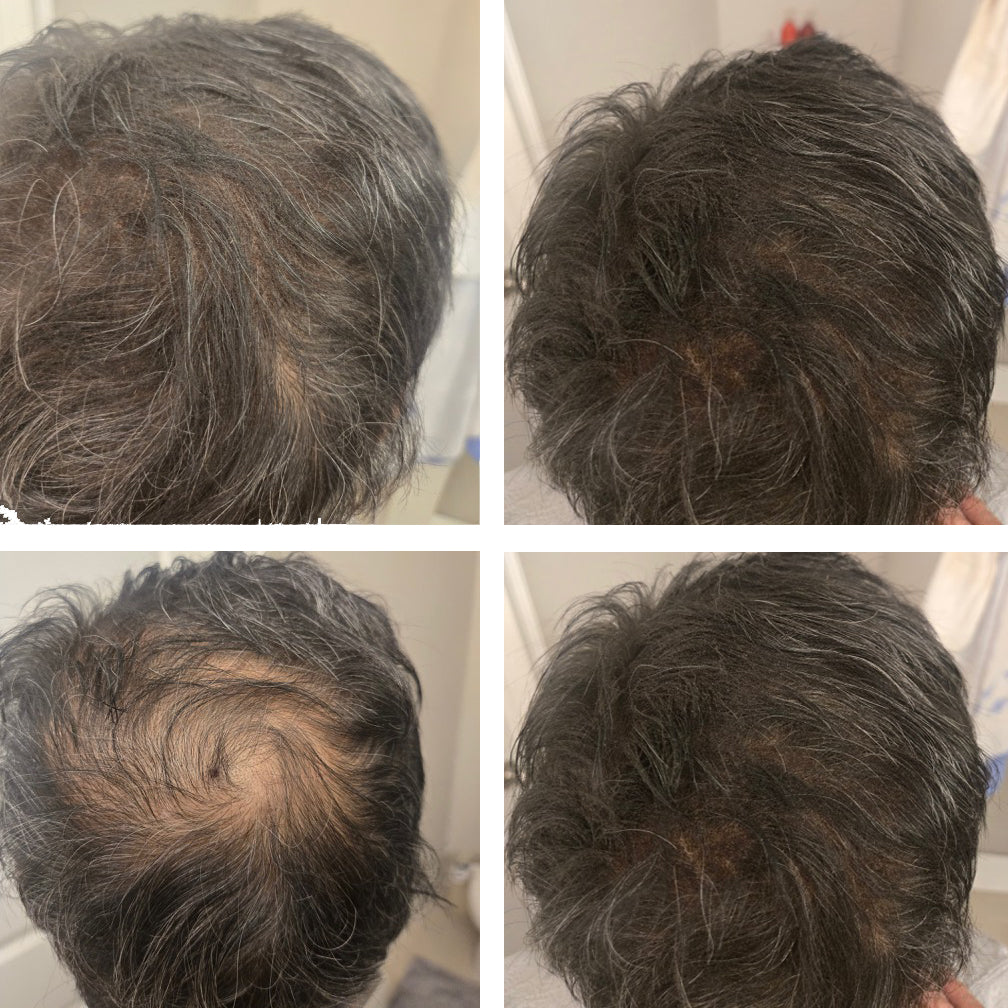 Medium Brown Hair Filler