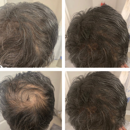 Medium Brown Hair Filler